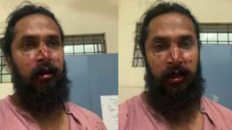 Chetan Chandra: ఘోరంగా నటుడిపై దాడి.. రక్తం దెబ్బలతో ఇన్‌స్టాగ్రామ్ లైవ్‌లోకి..