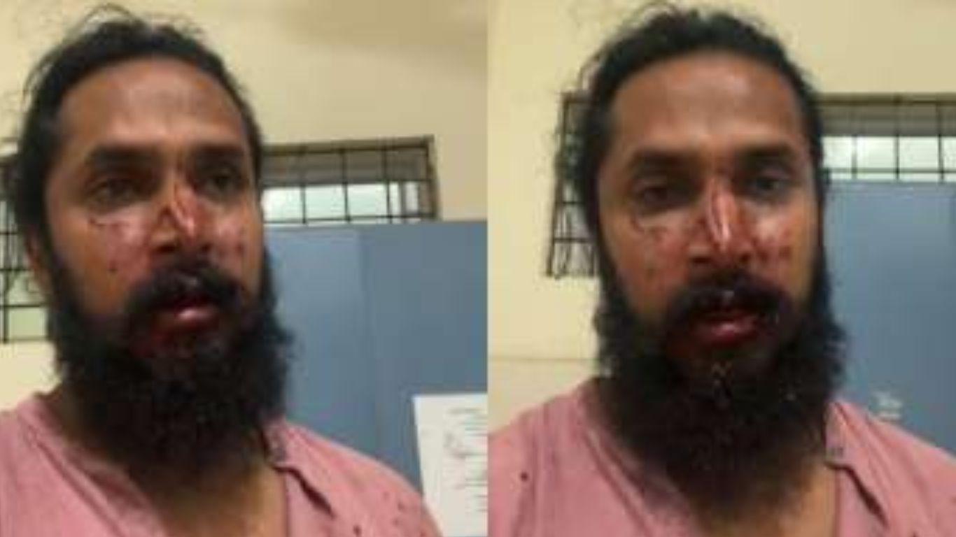 Chetan Chandra: ఘోరంగా నటుడిపై దాడి.. రక్తం దెబ్బలతో ఇన్‌స్టాగ్రామ్ లైవ్‌లోకి..