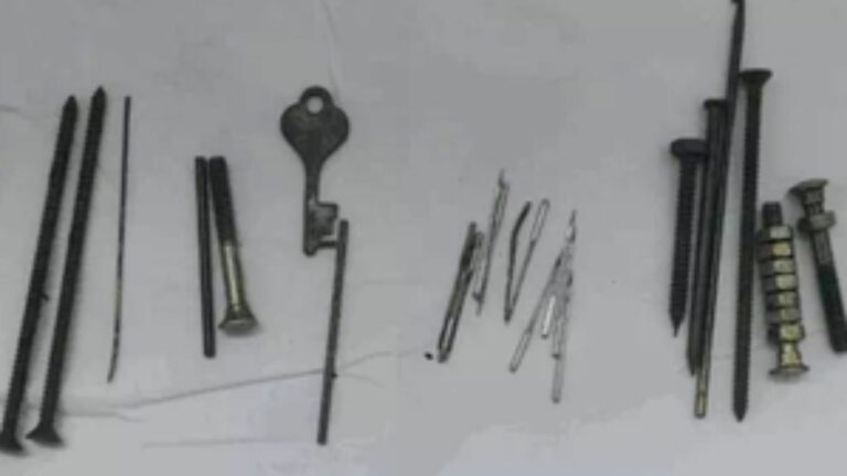 Man Stomach: అది కడుపా లేక.. గ్యారేజా.. వ్యక్తి కడుపులో గోళ్లు, సూదులు, బోల్ట్‌లు..