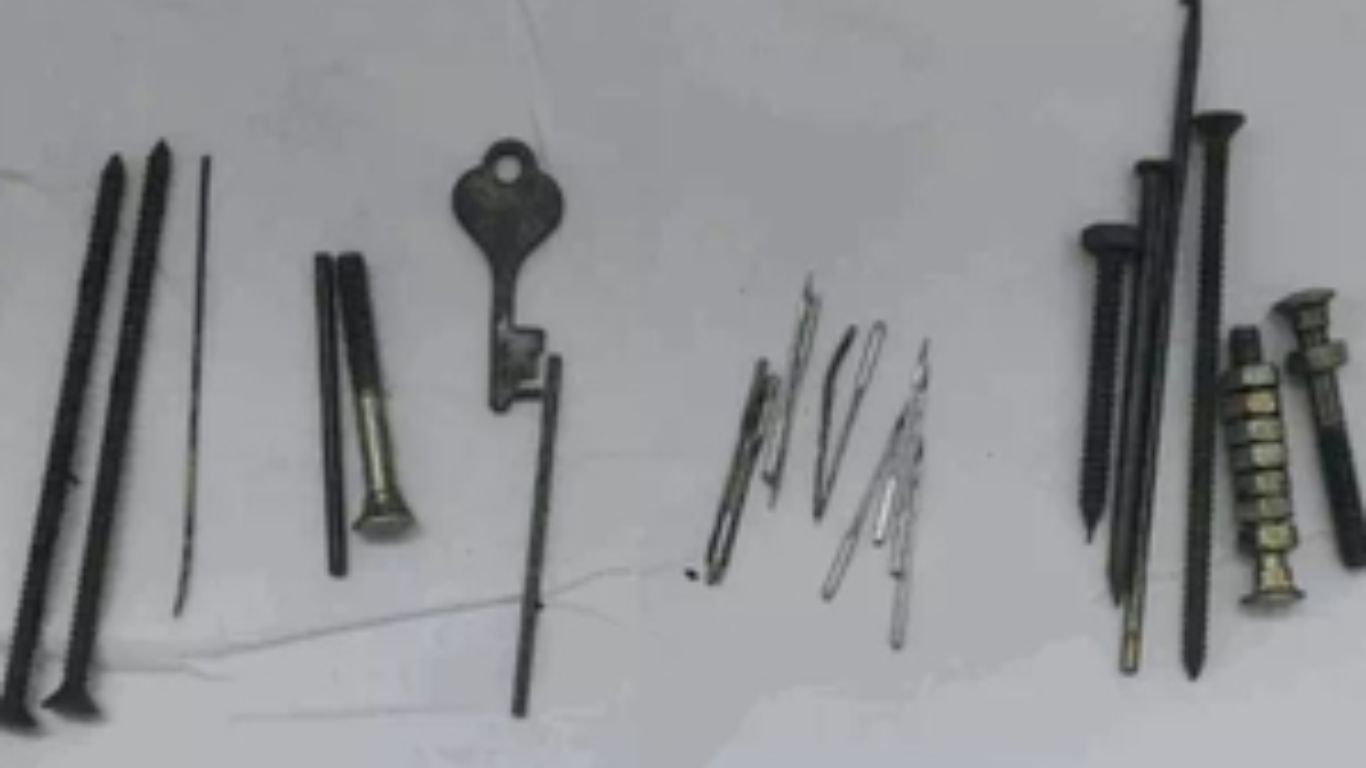 Man Stomach: అది కడుపా లేక.. గ్యారేజా.. వ్యక్తి కడుపులో గోళ్లు, సూదులు, బోల్ట్‌లు..