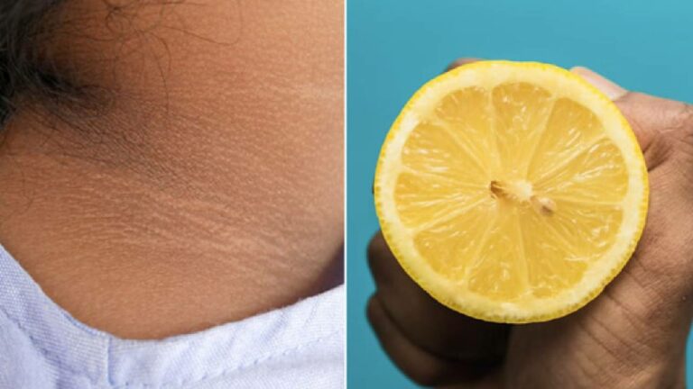 Black Neck Home Remedies:  మెడ భాగంలోని నల్లటి చర్మం కాంతి వంతంగా మారాలంటే ఇలా చేయండి