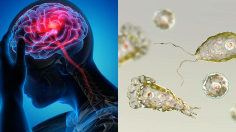 Brain-Eating Amoeba: “మెదడును తినే అమీబా” ఇన్ఫెక్షన్‌తో ఐదేళ్ల బాలిక మృతి..
