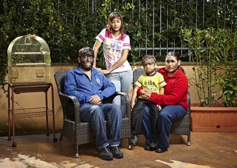 Wolf Man: ప్రపంచంలోని అత్యంత వెంట్రుకల కుటుంబం.. ఎక్కడో తెలుసా..