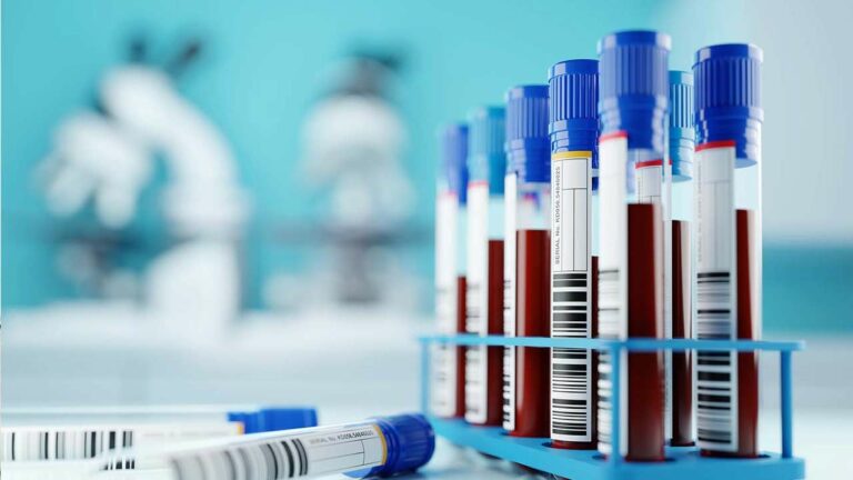 TSDCA : రక్త ప్లాస్మాపై TSDCA సలహా..!