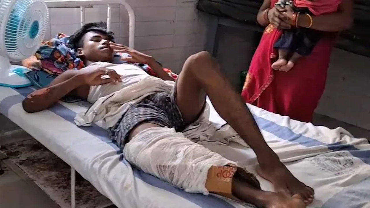 Bihar: విరిగిన కాలుకు ప్లాస్టర్ బదులుగా అట్టపెట్టె.. ఇదేం వైద్యం రా.. బాబు