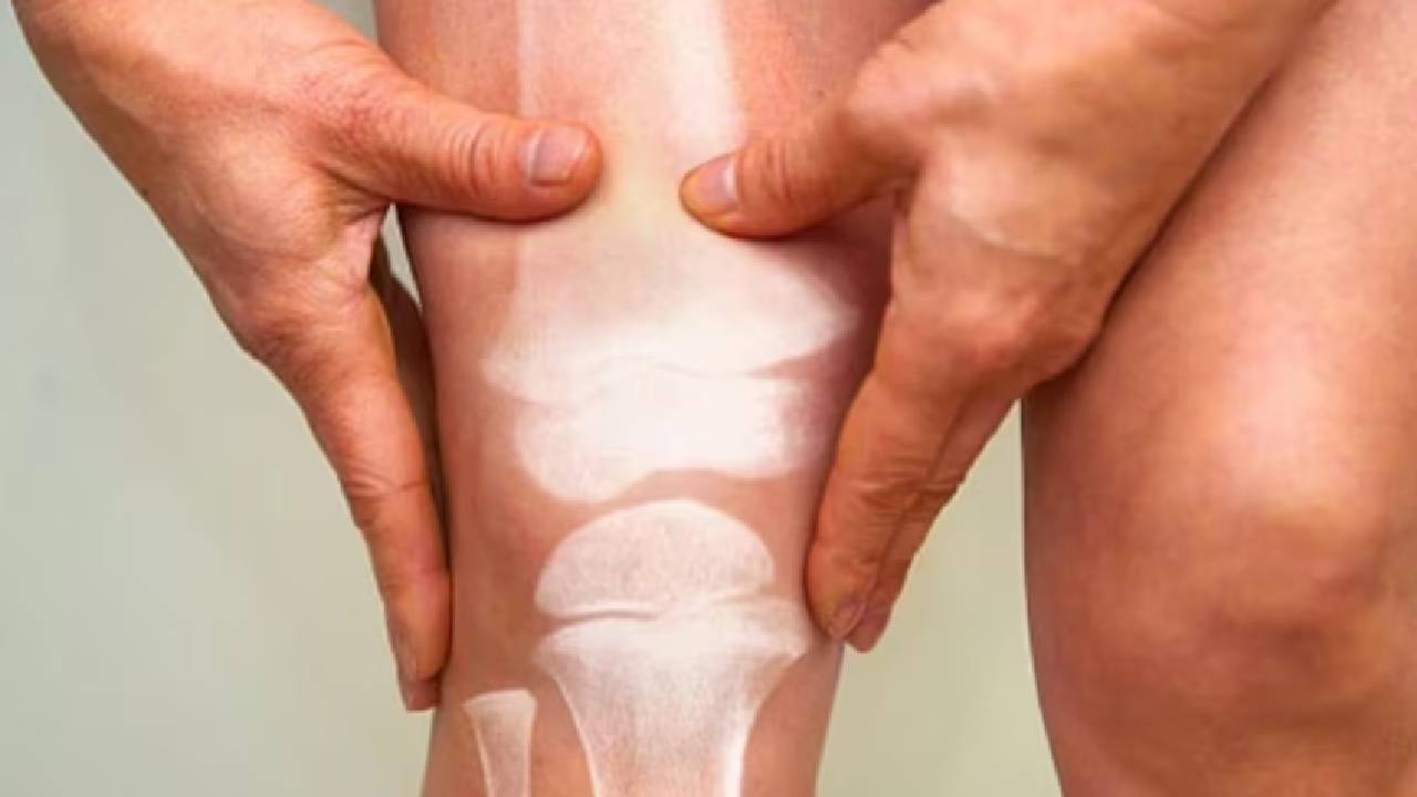 Bones: ఎముకలు ఆరోగ్యంగా ఉండాలంటే ఈ ఆహార పదార్థాలు తీసుకోండి