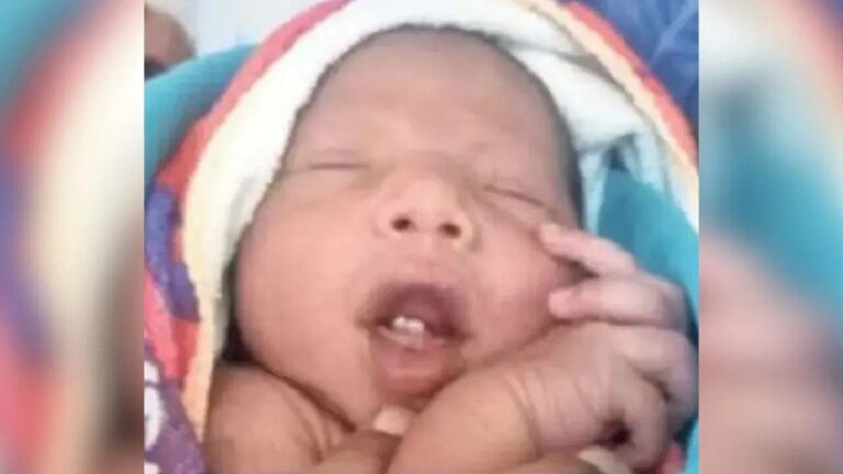 Jharkhand : నోటిలో దంతాలతో పుట్టిన శిశువు.. అవాక్కైన డాక్టర్లు