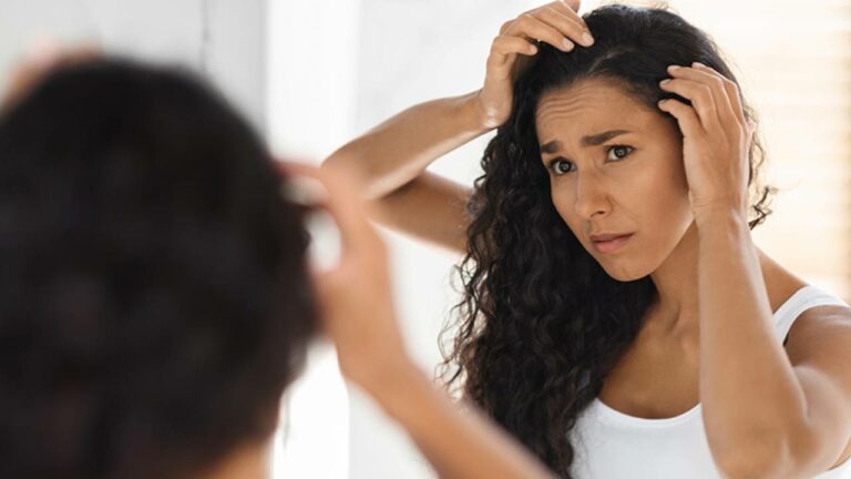 Dandruff Problem : చుండ్రు వదలడం లేదా అయితే దీనిని మీ జుట్టుకు అప్లై చేయండి