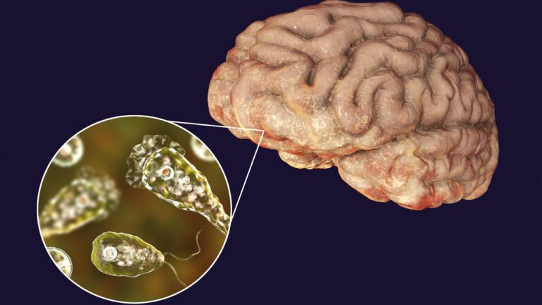 Amoeba: చిన్న పిల్లల మెదడును తినే అమీబా లక్షణాలు ఇవే.. నివారణ పద్దతులు ఏంటంటే..?