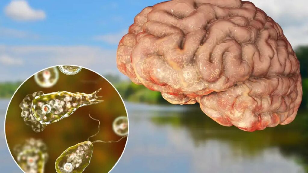 Brain Eating Amoeba