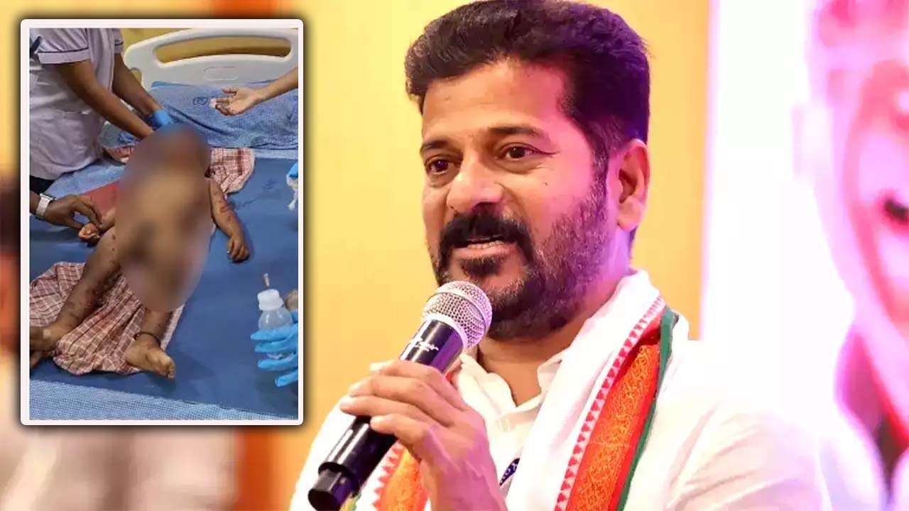 CM Revanth Reddy: కుక్కల దాడిలో బాలుడు మృతి ఘటన.. ఆవేదన వ్యక్తం చేసిన సీఎం..