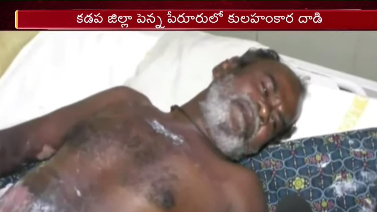 Crime News: కడప జిల్లాలో కులహంకార దాడి.. కర్రతో కొట్టి మరిగే నూనె పోశారు..