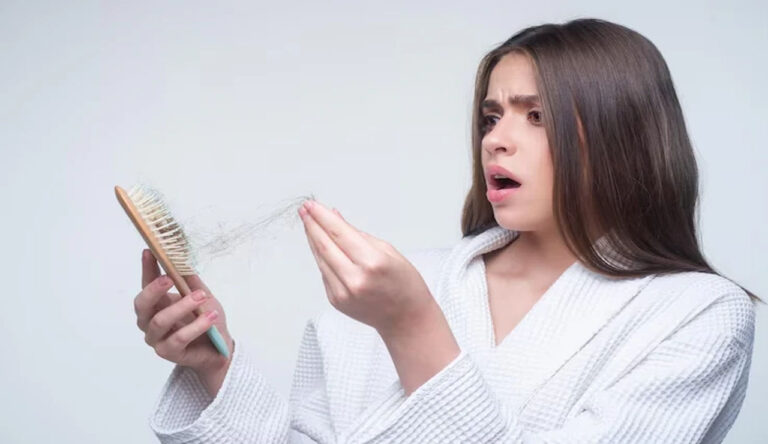 Hair Loss : మీ జుట్టు ఎక్కువ రాలిపోతుందా.. ఐతే ఇవి తినాల్సిందే..