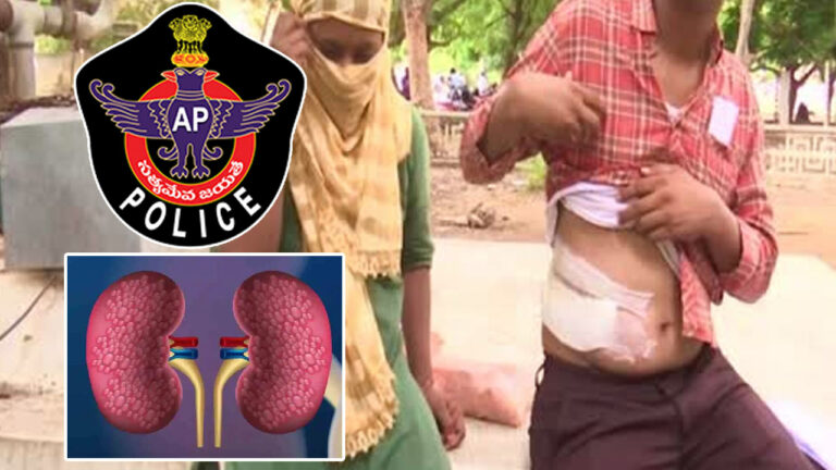 Kidney Racket Scam: కలకలం రేపుతోన్న కిడ్నీ మాఫియా.. మూలాలపై పోలీసుల ఫోకస్