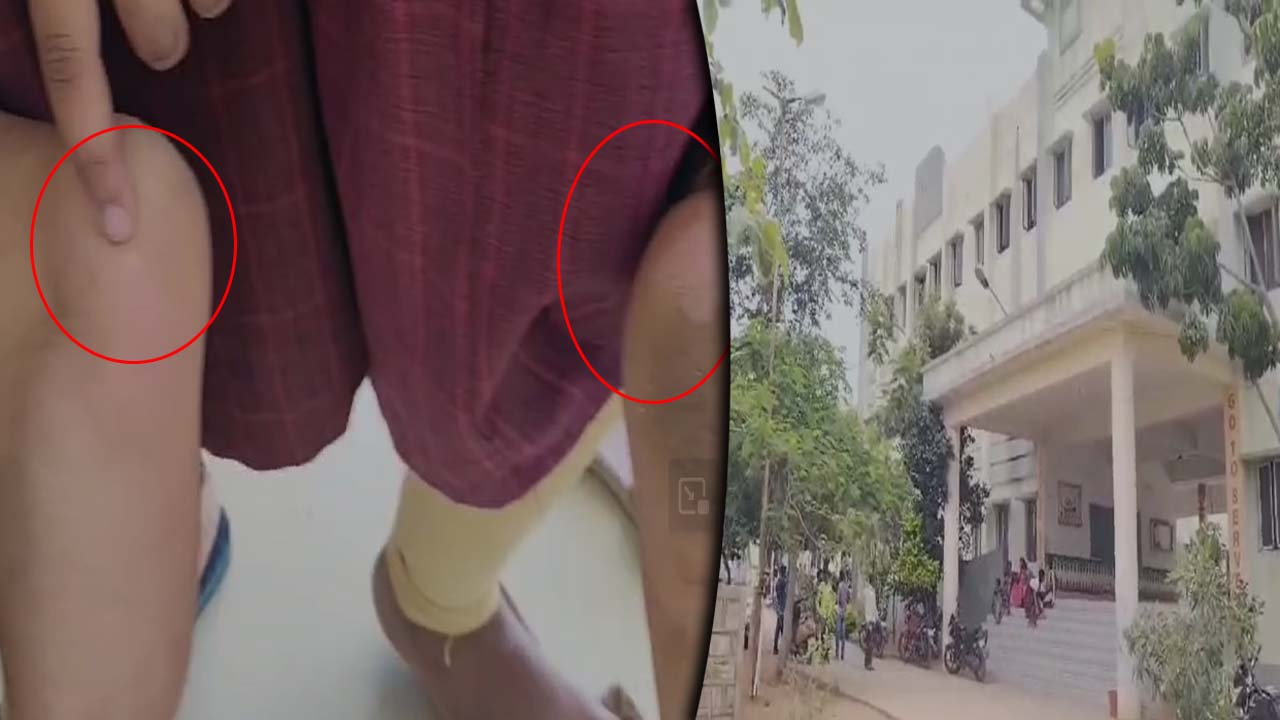 Medak: బాలికల పాఠశాలలో ఎలుకలు స్త్వైర విహారం.. పట్టించుకోని అధికారులు