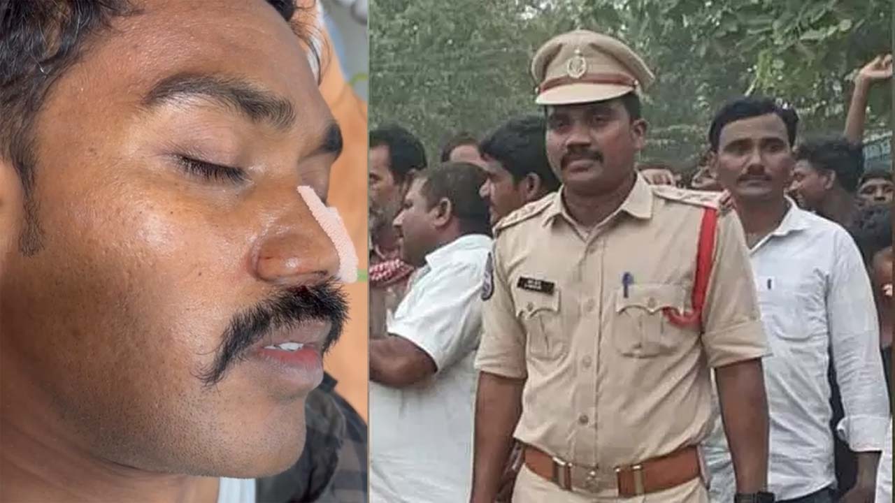 Ashwaraopet SI: అశ్వారావుపేట ఎస్సై ఘటన విషాదం.. చికిత్స పొందుతూ శ్రీనివాస్ మృతి..