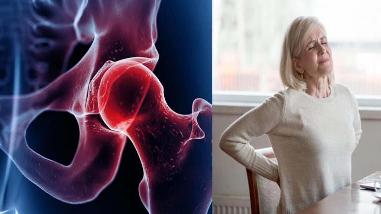 Women Health : మెనోపాజ్ తర్వాత మహిళల్లో బోలు ఎముకల వ్యాధి.. నివారించేందుకు చిట్కాలు ఇవే..