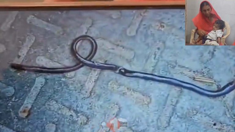 Bihar: పామును నోటితో కరిచి చంపేసిన చిన్నారి.. వైద్యుల దగ్గరకు తీసుకెళ్తే..!