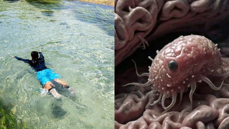 Brain Eating Amoeba: మరో ముగ్గురికి సోకిన మెదడును తినే అమీబా.. చెరువులో స్నానం చేయడానికి వెళ్లి..