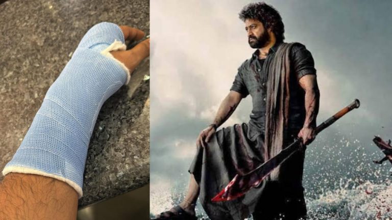 Jr NTR : జూనియర్ ఎన్టీఆర్ చేతికి గాయం.. అసలేమైందంటే?
