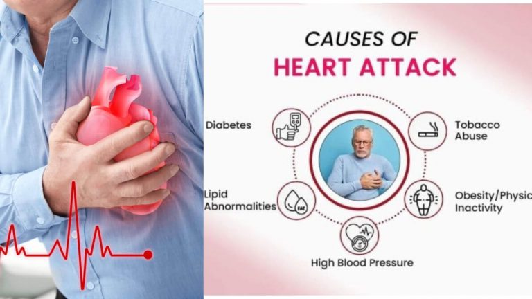 Heart Attack: ఈ అలవాట్లు మానుకోకపోతే గుండెపోటు ఖాయం.. జాగ్రత్త సుమీ..