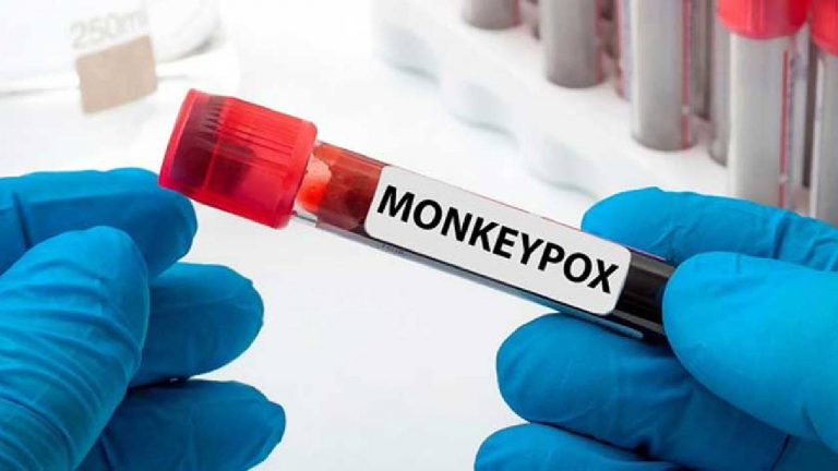 Mpox: కాంగోలో ఎంపాక్స్ విధ్వంసం, 570 దాటిన మరణాలు.. వ్యాక్సిన్ కోసం ఎదురుచూపులు..