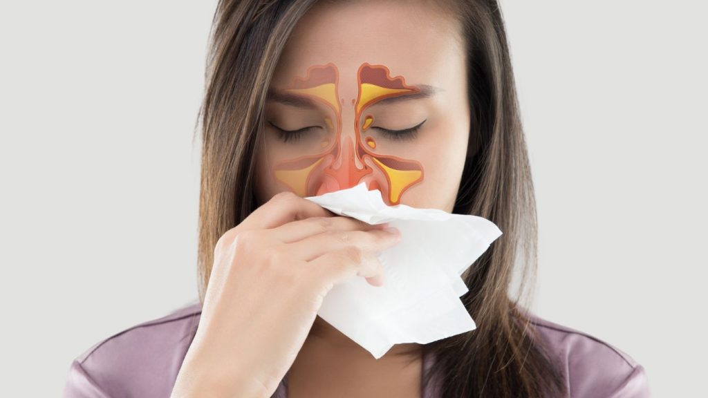 Nose Congestion