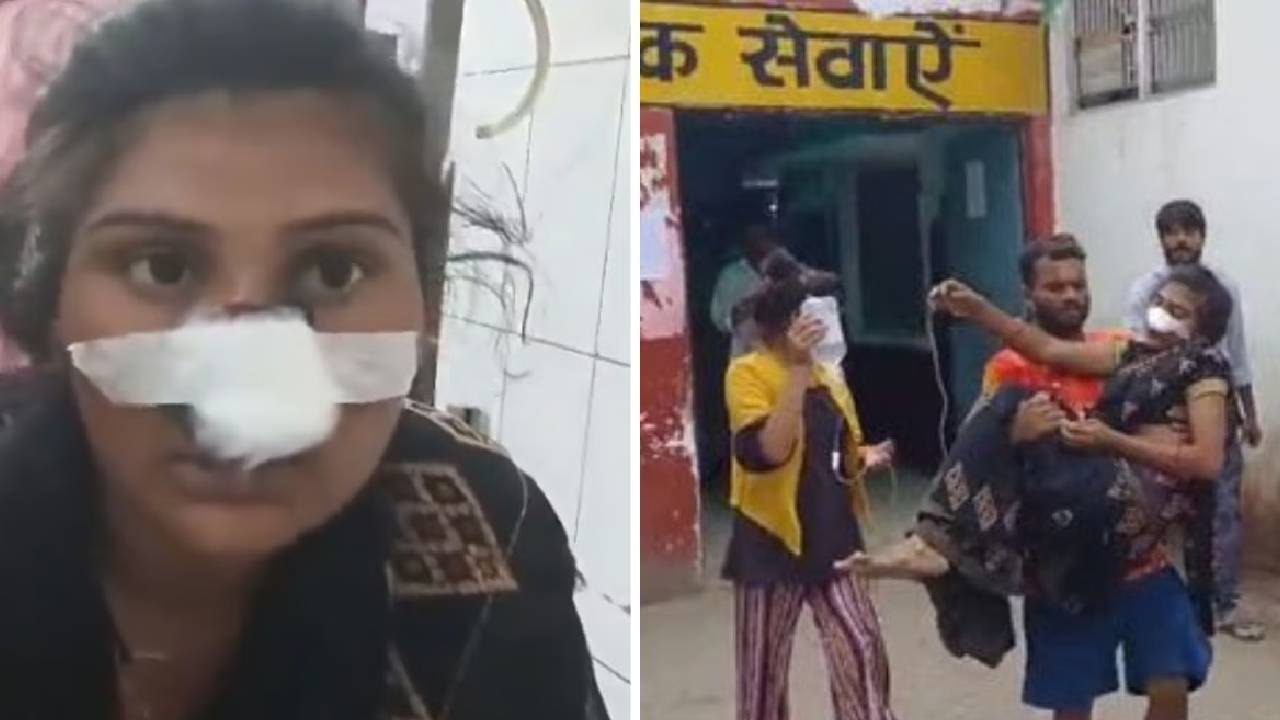 UP News: భార్య ముక్కు కోసేసిన భర్త.. కారణం ఏంటంటే..?