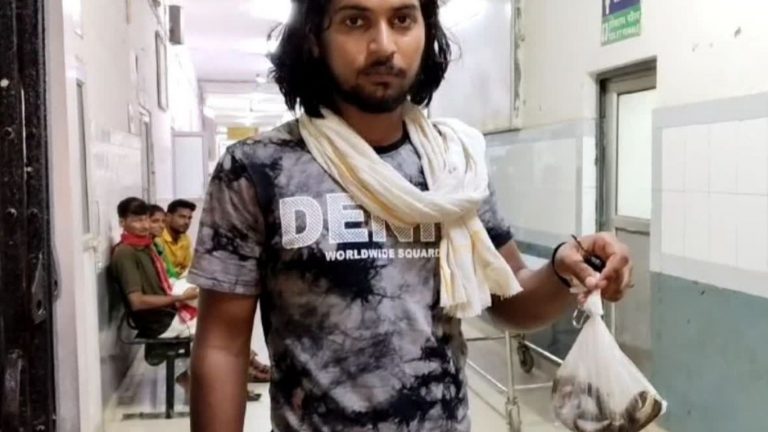 Snake Byte: ప్లాస్టిక్ బ్యాగ్ లో పామును తీసుకొచ్చి ఆస్పత్రిలో హంగామా చేసిన యువకుడు..