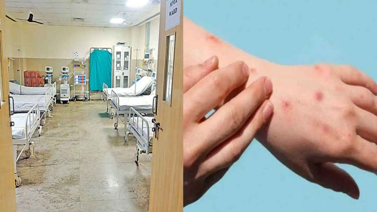 Monkeypox: మంకీపాక్స్⁬కు విజయవాడ ప్రభుత్వ ఆసుపత్రిలో ప్రత్యేక వార్డు