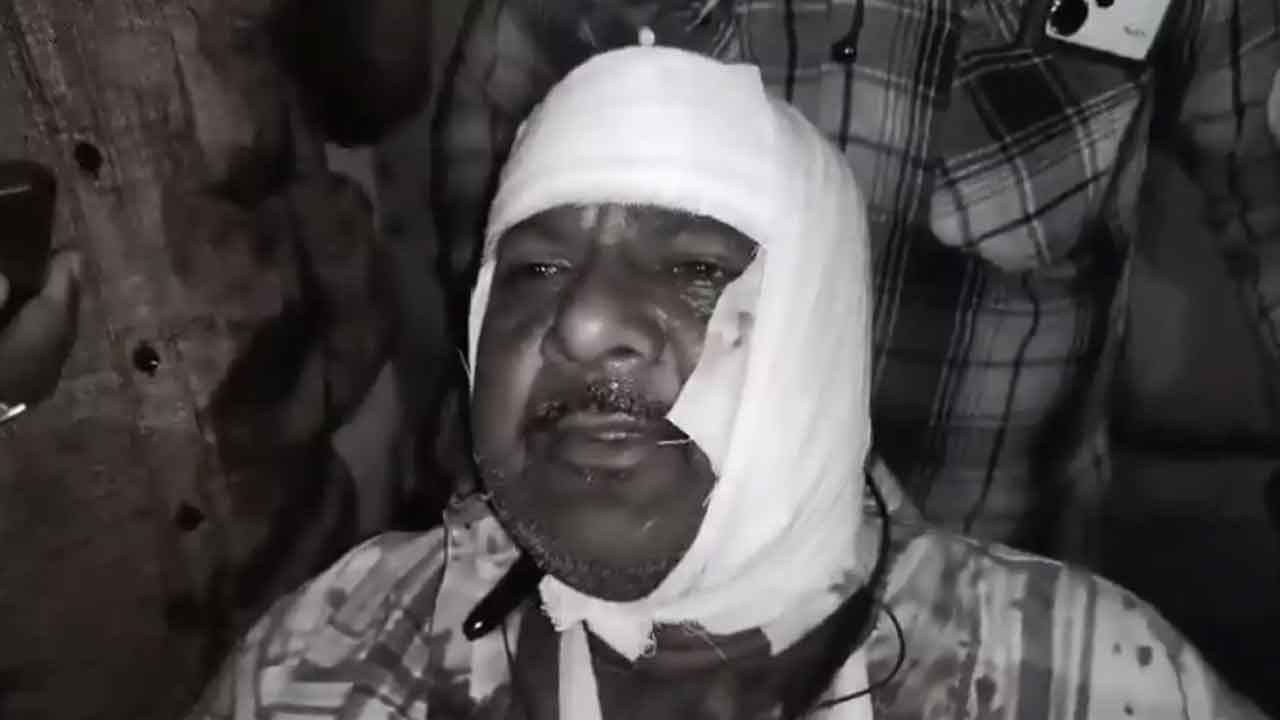 Attack : హైదరాబాద్‌లో యూట్యూబర్‌పై రౌడీషీటర్‌ దాడి