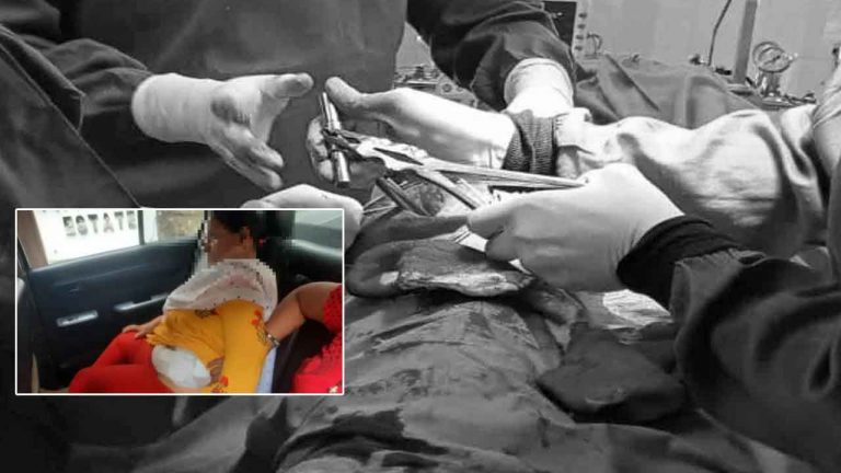 Anantapur: ప్రభుత్వ ఆస్పత్రి వైద్యుడి నిర్వాకం.. గర్భసంచి ఆపరేషన్ కోసం వెళ్తే.. మూత్రనాళం తొలగింపు..!