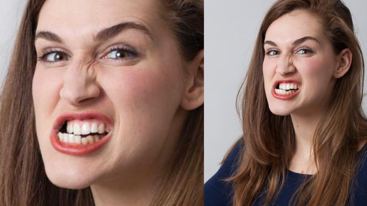 Bruxism Teeth: నిద్రలో పళ్లు కొరుక్కోకుంటున్నారా.? ఇలా చేసి ఉపశమనం పొందండి!