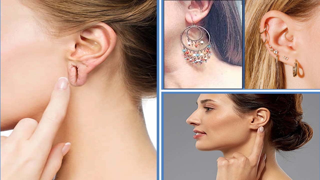 Ear Hole Tips: చెవి రంధ్రం సాగుతున్నాయా..? ఈ చిట్కాలు పాటించండి..!