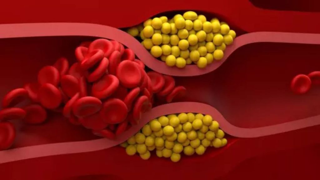 Good Cholesterol Vs Bad Cholesterol