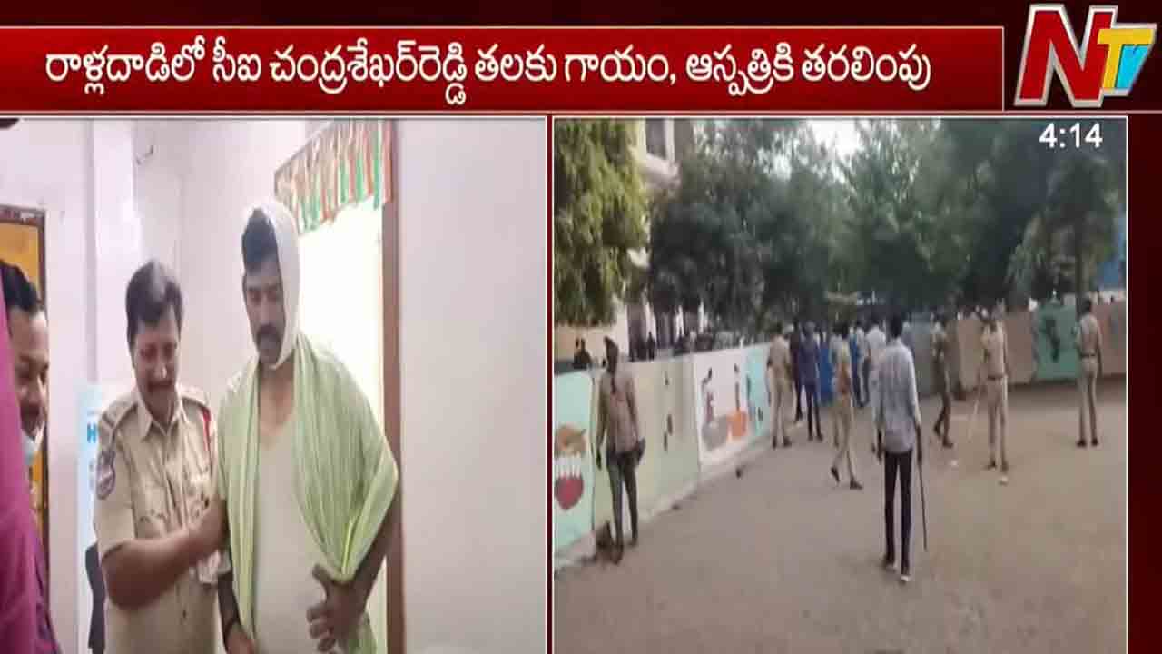 Breaking: కామారెడ్డిలో హై టెన్షన్.. పోలీసులపై రాళ్లు, సీఐ తలకు గాయం