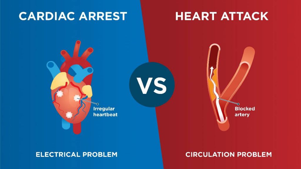 Key Difference Between Heart Attack And Cardiac Arrest