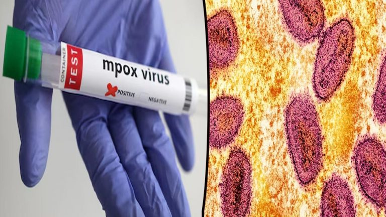 Mpox Cases: భారత్⁭లో మంకీపాక్స్‌ కలకలం.. రాష్ట్రాలకు కేంద్రం కీలక సూచనలు..!