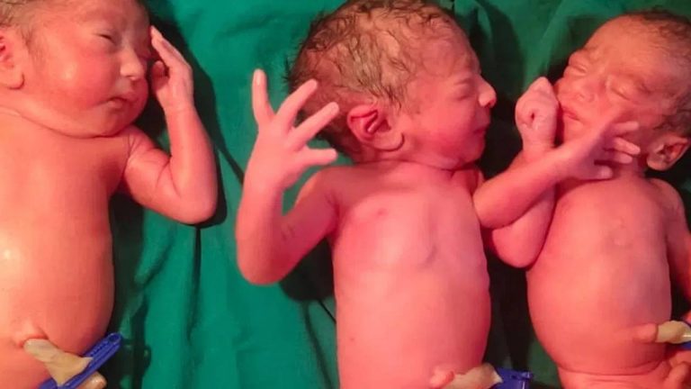 Andrapradesh : పెళ్లై ఐదేళ్లయిన పిల్లల్లేరు.. కానీ ఇప్పుడు ఒకే కాన్పులో ముగ్గురు