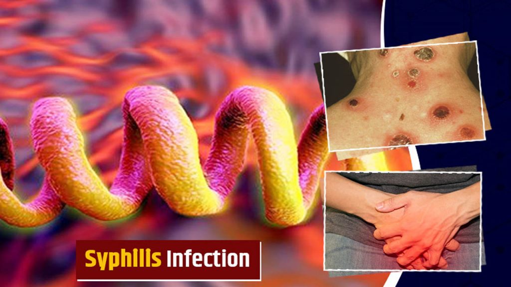 Syphilis Virus