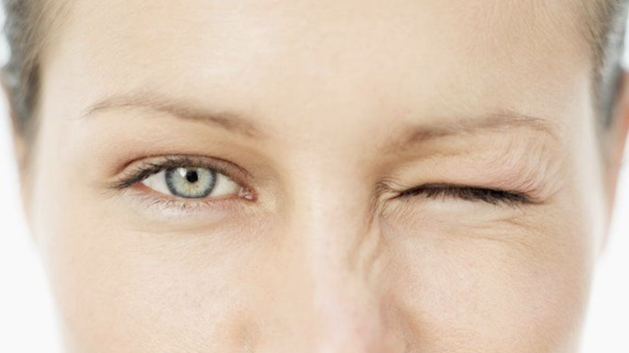 Eye Twitching: పదే పదే కళ్లు కొట్టుకుంటున్నాయా.? మీలో ఈ సమస్యలు ఉన్నట్లే.!