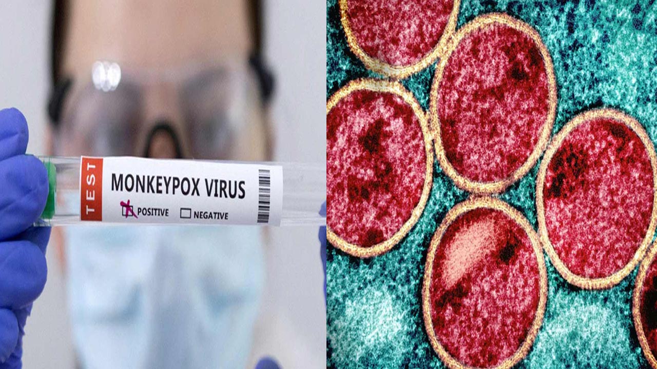 First Mpox Case In India: భారత్‌లో తొలి మంకీ పాక్స్‌ కేసు..