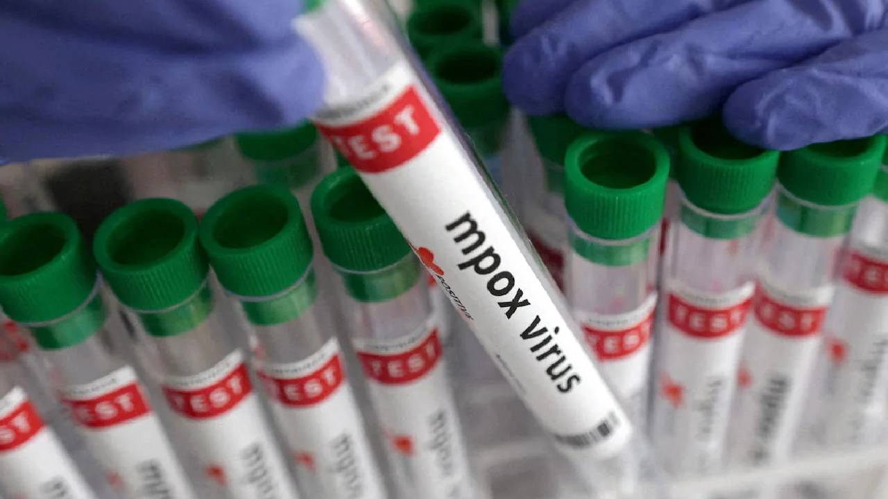 Mpox Clade 1b: ఇండియాలో తొలిసారిగా ప్రమాదకరమైన ఎంపాక్స్ వెరైటీ గుర్తింపు..