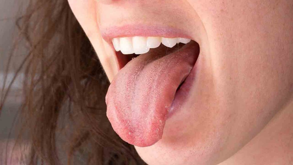 Tongue