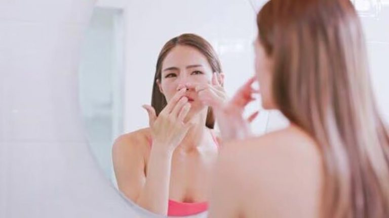 Beauty Tips: బ్లాక్ హెడ్స్, వైట్ హెడ్స్‌తో ఇబ్బంది పడుతున్నారా..? ఇది ట్రై చేయండి