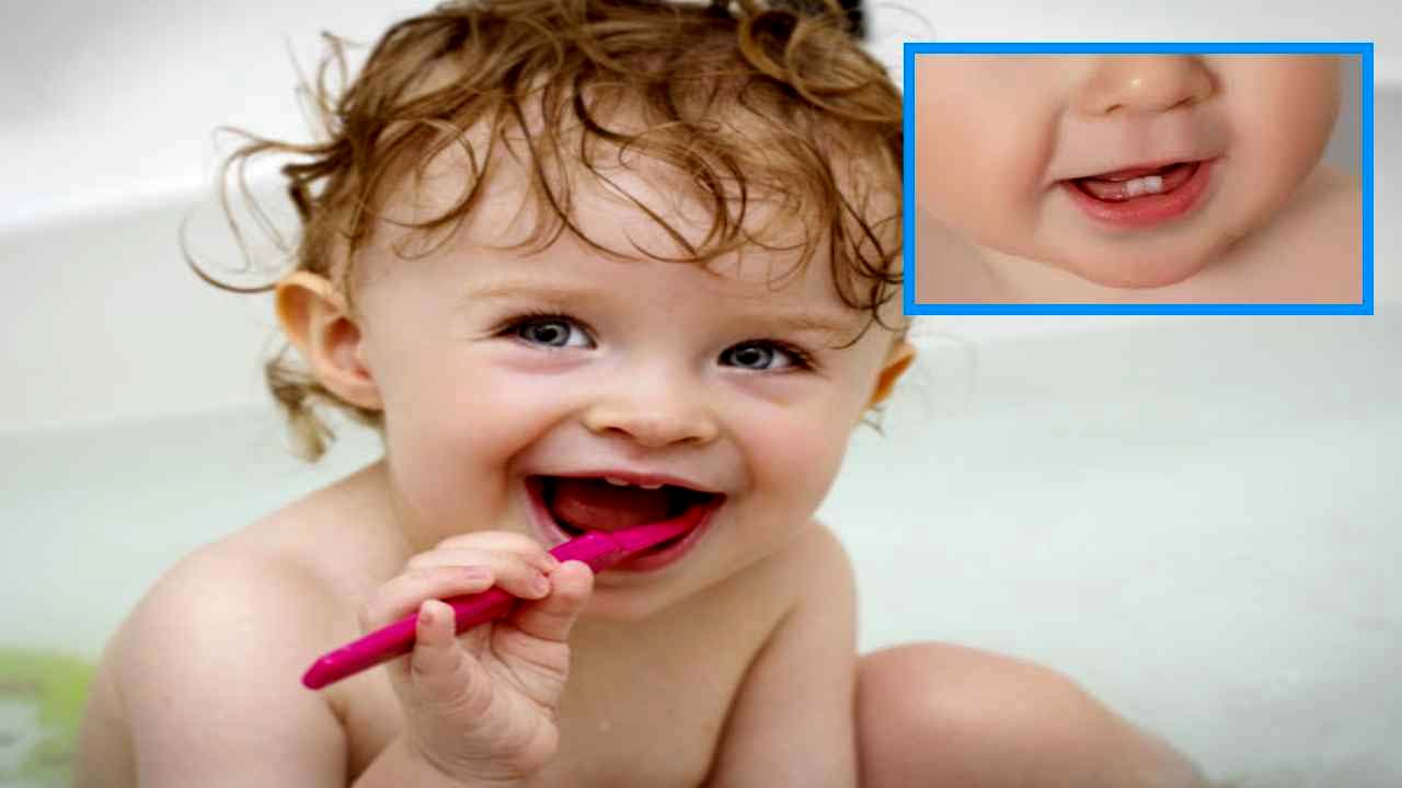 Children Teeth Problems: చిన్నపిల్లలకు దంతాలు ఇలా వున్నాయా.. సమస్యలు తప్పవు..