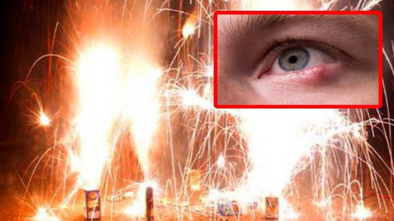 Diwali 2024: దీపావళి రోజు ఈ సమస్యల వల్ల కళ్ళకు ప్రమాదం.. జాగ్రత్తగా లేకపోతే..?