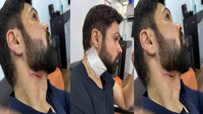 Imran Hashmi: ఇమ్రాన్ హష్మీ మెడకు గాయం.. ఏమైందంటే?