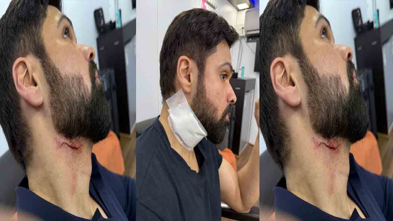 Imran Hashmi: ఇమ్రాన్ హష్మీ మెడకు గాయం.. ఏమైందంటే?