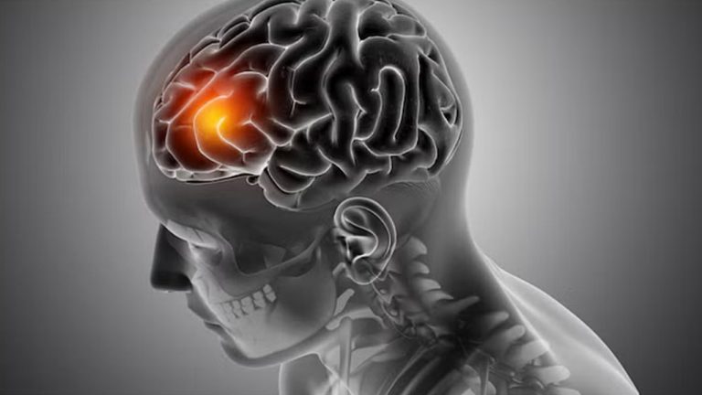 Health: ముప్పై ఏళ్లలో 18 శాతం పెరిగిన ఈ ప్రాణాంతక సమస్య కేసులు..